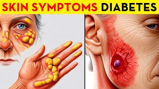 Your Skin Might Be Hiding These 15 Diabetes Symptoms [upl. by Rosalyn472]