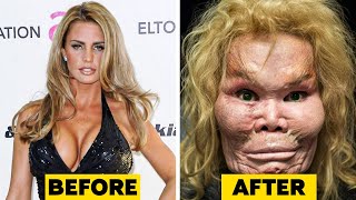 20 Celebrity Plastic Surgery Disasters [upl. by Annayak691]