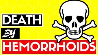 Can You Die From A Hemorrhoid Do Piles Cause Death  Best Hemorrhoids amp Piles Answers [upl. by Mundy]