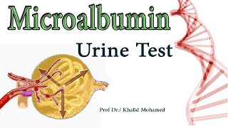 Microalbumin MA Urine Albumin Albumin to Creatinine Ratio [upl. by Atteynek455]