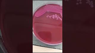 Klebsiella pneumonia grow in macConkey agar for blood cs  Microbiologist  bacterilogh microb mp [upl. by Amsirak]