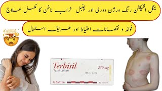 Terbisil tablet uses in urdu  terbisil tablet 125mg  terbisil tablet 250mg how to use terbinafine [upl. by Eddana]