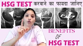 HSG TEST का फायदा जिस से मेरा Conceive हुआ HSG TUBE TEST Benefits in Hindi [upl. by Kendra]