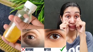 धंसी हुई आंखों  कालापन  झुर्रियां रातों रात ठीक करें Eye Serum [upl. by Garrek]