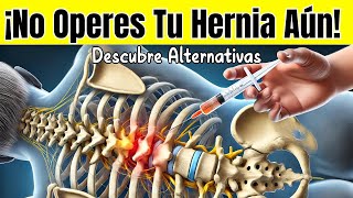 😱 quot¡Alerta La Verdad Oculta Detrás de las Cirugías de Hernia de Discoquot [upl. by Pani]