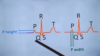 Important Normal Values for ECG [upl. by Alusru]