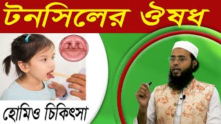 গলায় টনসিল হলে করণীয়  Tonsillitis Treatment  টনসিল ফুলে গেলে করণীয়  Tonsil Homeo Medicine [upl. by Scevor]