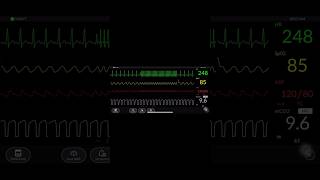 Curs quotElectrocardiograma și interpretarea aritmiilor cardiace de bazăquot [upl. by Safko413]