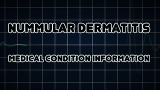 Nummular dermatitis Medical Condition [upl. by Wendelin505]