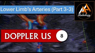 8  Lower Limbs Arteries Part 33 [upl. by Ellita]