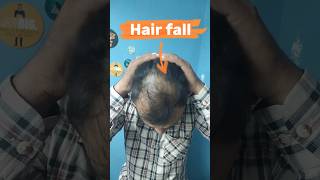 Adivasi hair oil vs minoxidil morr f5 adivasihairoilreview hairfallsolution minoxidil [upl. by Araminta]