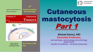 Cutaneous Mastocytosis Part 1 [upl. by Mauralia]