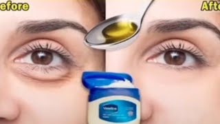 Treat wrinkles dark circles under eyebags amp fine lines at home 🤩😍viralvideoshortvideo subscribe [upl. by Silbahc]