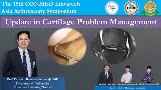 Update in Cartilage Problem Management CLASS meeting Cebu ProfDrmedBancha Chernchujit [upl. by Redmund]