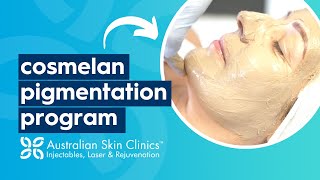 Cosmelan Pigmentation Program at Australian Skin Clinics [upl. by Ayotac]