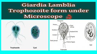 shorts  Giardia Lamblia Trophozoite form under Microscope 🔬 during Stool examination [upl. by Seve720]