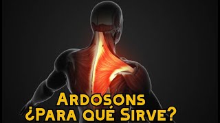 Ardosons ¿Para qué Sirve [upl. by Ativel]