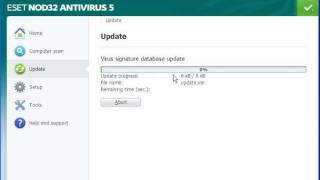 شرح تفعيل تسجيل النود انتى فيرس the activation of ESET NOD32 Antivirus [upl. by Hegarty702]