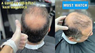 Hair Fibers Transformation  No Need Hair Transplant or Wig  JASON MAKKI Extra Hair Fibers [upl. by Lune934]