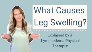 Causes of Leg Swelling Ankle Edema and Swollen Feet [upl. by Fachan944]