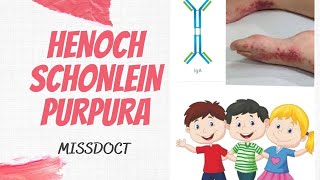 HENOCH SCHONLEIN PURPURA IgA Vasculitis [upl. by Mychael]