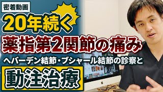 診察風景 密着動画 20年以上続く指の痛み（くすり指第2関節）へバーデン結節・ブシャール結節の診察風景と動注治療 [upl. by Aletta866]