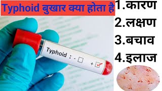 typhoid fever  typhoid ke lakshan 90डॉक्टर बेवकूफ बनाते है typhoid fever treatment typhoidfever [upl. by Thorn]