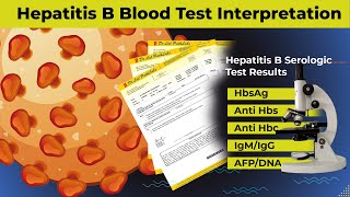 Microbiology 550 c Hepatitis B HBV Dane PArticle HBsAg HBeAg HBcAg Antigen surface core antibodies [upl. by Sollars]