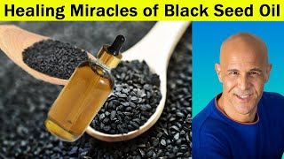 Healing Miracles of Black Seed Oil with Dr Mandell Live Chat Stream [upl. by Anitnas]