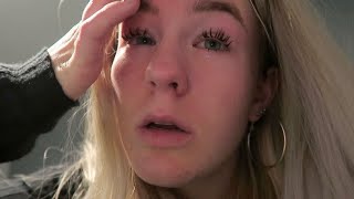 ALLERGISCHE REACTIE😵 DAILY VLOG 148❤️ [upl. by Ide]