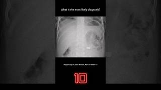 Abdominal Xray Question 5 [upl. by Isacco]