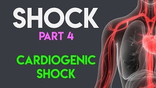 Cardiogenic Shock  Shock Part 4 [upl. by Holly-Anne]