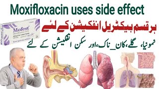 moxifloxacin 400 mg uses in urdu moxifloxacin 400 mg  Mofest 400mg  X gen 400mg  Avelox 400mg [upl. by Meill]