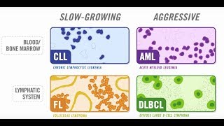 The Diversity Of Blood Cancer [upl. by Nea]