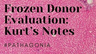 Frozen Organ Donor Evaluation Kurt’s Notes pathagonia [upl. by Loleta551]