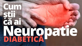 Cum știi SIGUR că ai NEUROPATIE diabetică [upl. by Henghold132]