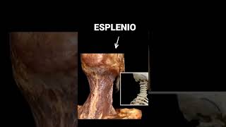 ASÍ ES EL ESPLENIO DE LA CABEZA 🫢 gym anatomy medicina [upl. by Razaele554]