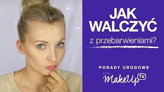 Jak walczyć z przebarwieniami Karolina [upl. by Rosena]