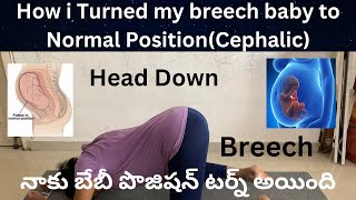 How i turned my breech baby to Normal positionCephalic pregnancy viralvideo [upl. by Hteboj]