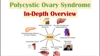 Polycystic Ovary Syndrome PCOS  Overview of Associated Conditions Diagnosis amp Treatments [upl. by Eenot495]