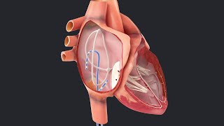 ELECTROPHYSIOLOGIE CARDIAQUE PARTIE1 [upl. by Sowell]