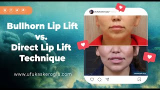 Bullhorn Lip Lift vs Direct Lip Lift Technique [upl. by Willow]