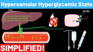 Hyperosmolar Hyperglycemic Nonketotic Syndrome  Panmedicad [upl. by Molini]