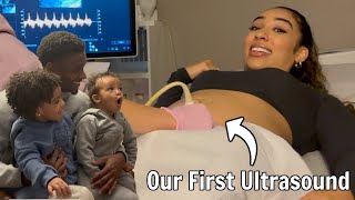 OUR FIRST ULTRASOUND Emotional [upl. by Naoma]