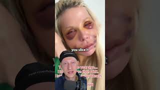 INTENSE Plastic Surgery Recovery  Plastic Surgeon Reacts [upl. by Arrol]