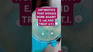 The antibiotics are AMIKACINAK MEROPENEMMEM CIPROFLOXACINCIP TAZOBACTAMTZP AND GENTAMICINCN [upl. by Nnylyma]