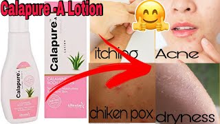 Calapure A Lotion Uses  Calamine Lotion  Review in English [upl. by Nnanerak95]