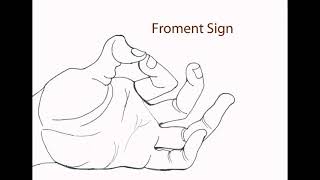 شرح بالعربي لـ Froment sign [upl. by Geminius783]