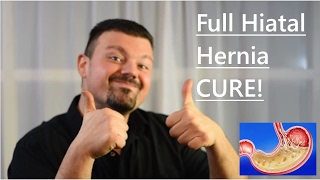 Hiatal hernia full cure UPDATE [upl. by Amero]