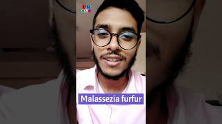 Dandruff  খুশকি  Fungal infection  Malassezia furfur  Dr Med  Sakib Rahaman [upl. by Crockett]